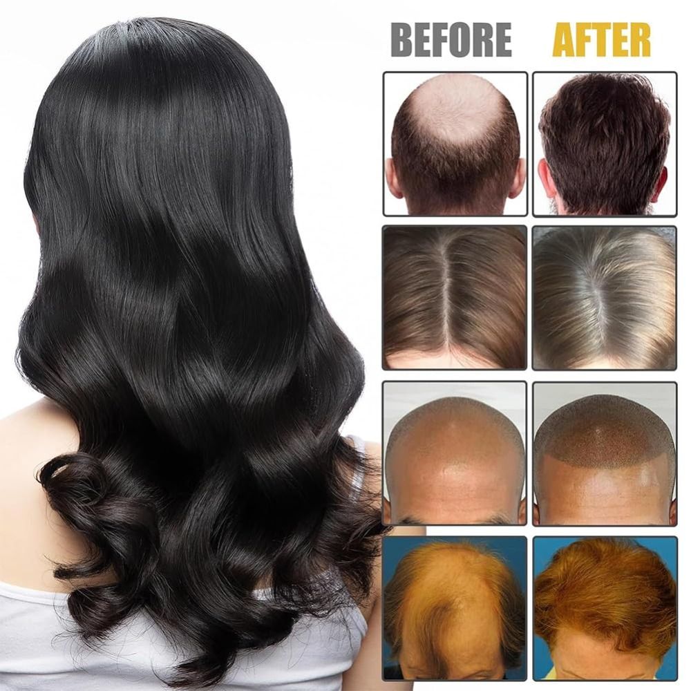 New Nourishes Hair Roots Vorte - Hair Care Formulation ulasan dan harga