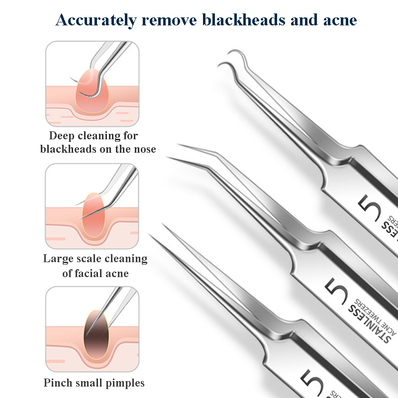 1Pcs Ingrown Hair Tweezers Acn - Hair Care Tools ulasan dan harga
