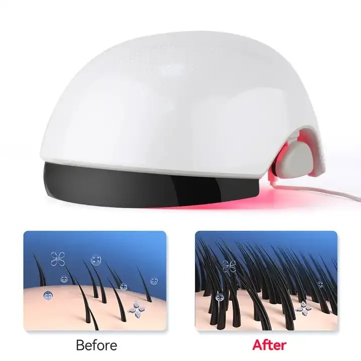 Red‑Light Hair Growth Helmet,  - Hair Care Lab ulasan dan harga